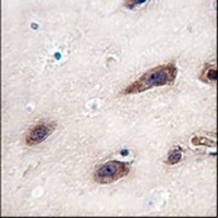 STX3 Rabbit Polyclonal Antibody