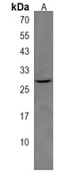 NMRK2 Rabbit Polyclonal Antibody