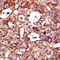 ZMPSTE24 Rabbit Polyclonal Antibody