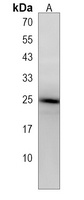 ARL2 Antibody