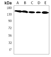 TNIK Rabbit Polyclonal Antibody