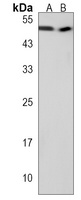TUBG2 Rabbit Polyclonal Antibody