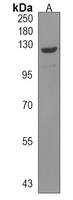 HEATR6 Rabbit Polyclonal Antibody