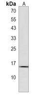SYNJ2BP Rabbit Polyclonal Antibody