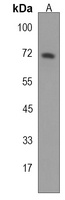 STT3A Rabbit Polyclonal Antibody