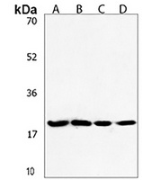 ANAPC11 Rabbit Polyclonal Antibody
