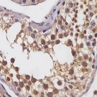 GLUT8 Rabbit Polyclonal Antibody