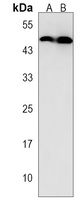 ACP6 Rabbit Polyclonal Antibody