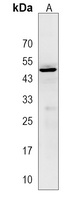 ACP6 Rabbit Polyclonal Antibody