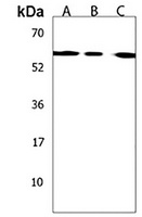 CCT8L2 Rabbit Polyclonal Antibody