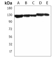 TACC3 Rabbit Polyclonal Antibody