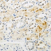 NAT8L Rabbit Polyclonal Antibody
