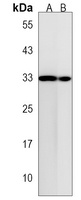 TMEM158 Rabbit Polyclonal Antibody
