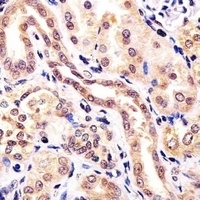 KCTD11 Rabbit Polyclonal Antibody