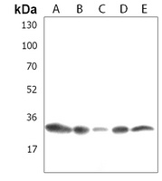 SSX1 Rabbit Polyclonal Antibody