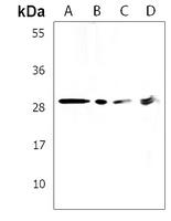 ACBD4 Rabbit Polyclonal Antibody