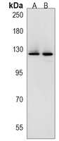 SRGAP3 Rabbit Polyclonal Antibody