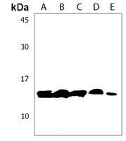 RNF7 Rabbit Polyclonal Antibody
