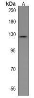 ABL2 Rabbit Polyclonal Antibody