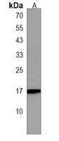 PLP2 Rabbit Polyclonal Antibody