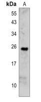 OMP Rabbit Polyclonal Antibody