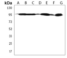 DNAJC6 Rabbit Polyclonal Antibody