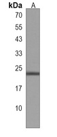 MRAP Rabbit Polyclonal Antibody