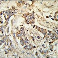 MRAP Rabbit Polyclonal Antibody
