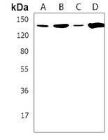 TAF2 Rabbit Polyclonal Antibody