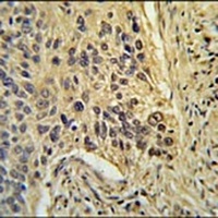 TAF2 Rabbit Polyclonal Antibody