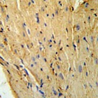 Phospholamban Rabbit Polyclonal Antibody