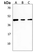 SGMS2 Rabbit Polyclonal Antibody