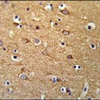 SGMS2 Rabbit Polyclonal Antibody