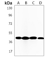 NDUFS2 Rabbit Polyclonal Antibody