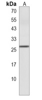 NMRK1 Rabbit Polyclonal Antibody