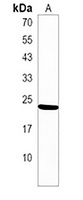 TIFA Rabbit Polyclonal Antibody