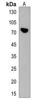 PLCZ1 Rabbit Polyclonal Antibody