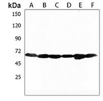 DLL3 Rabbit Polyclonal Antibody