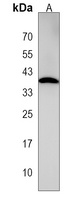 COQ5 Rabbit Polyclonal Antibody