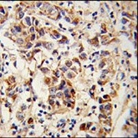 SPRR1B Antibody