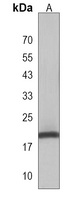DLK2 Antibody