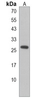 PEX11A Rabbit Polyclonal Antibody