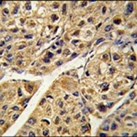 PEX11A Rabbit Polyclonal Antibody