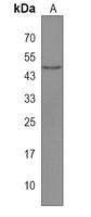 IPMK Rabbit Polyclonal Antibody