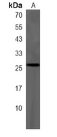RAB8A Rabbit Polyclonal Antibody