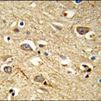 RAB8A Rabbit Polyclonal Antibody