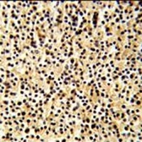 DTX1 Rabbit Polyclonal Antibody