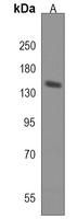 Adenylate Cyclase 8 Rabbit Polyclonal Antibody