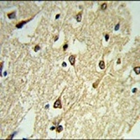 Adenylate Cyclase 8 Rabbit Polyclonal Antibody