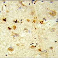 ITGBL1 Antibody